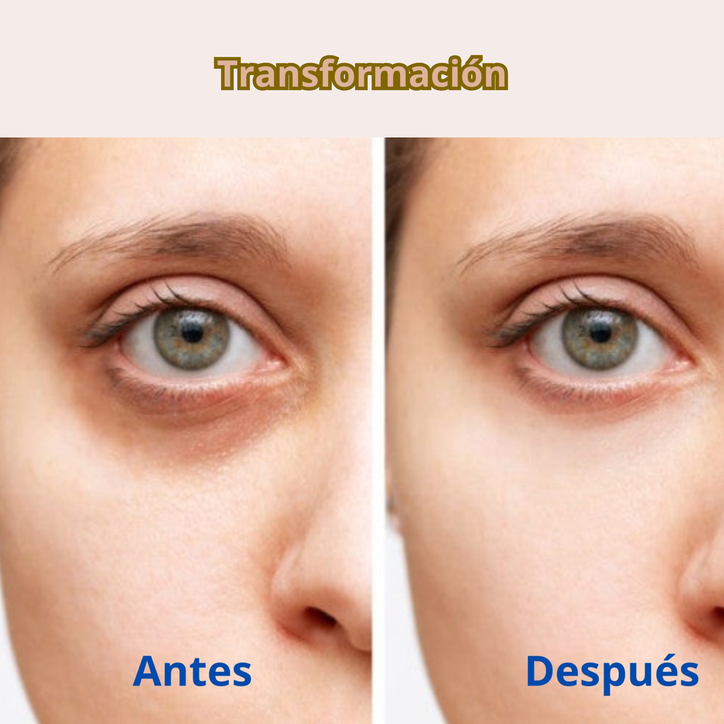 Hidroparche de caracol