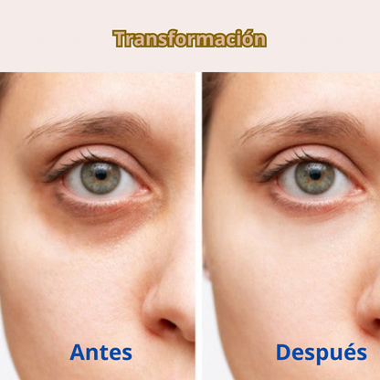 Hidroparche de caracol