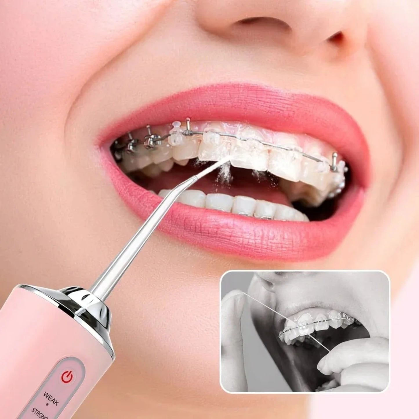 Limpiador Dental Eléctrico, Irrigador