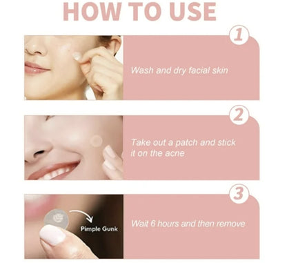 El Secreto Invisible: Parches Anti-Acné de Curación Rápida que Nadie Notará